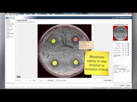 how to measure zone of inhibition bacteria