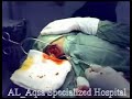 neurosurgery neurosurgery