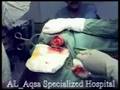 neurosurgery