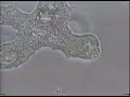 Amoeba Feeds! Amoeba Feeds!
