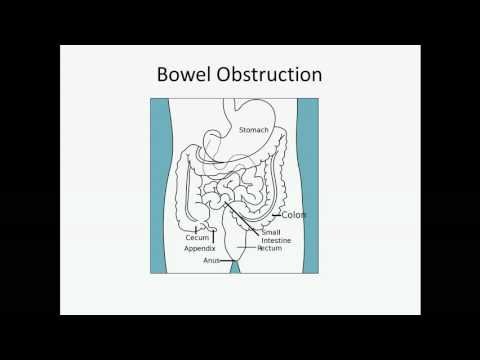 how to relieve bowel obstruction