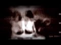Manhunt 2 Official Trailer [PSP, PS2, Wii]