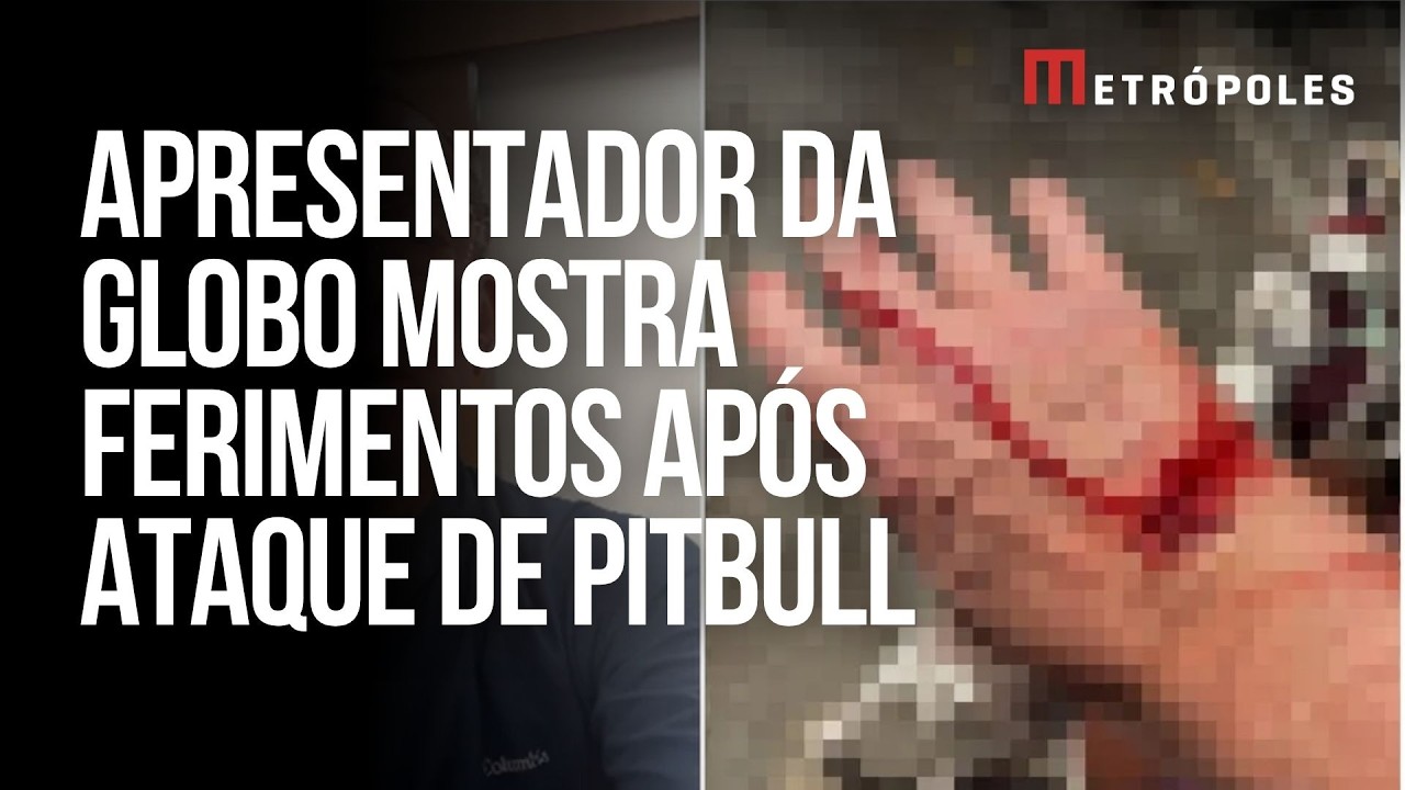 Apresentador da Globo é atacado por pitbull e mostra ferimentos