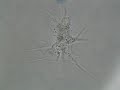 Amoeba under microscope III Amoeba under microscope III