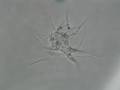 Amoeba under microscope III