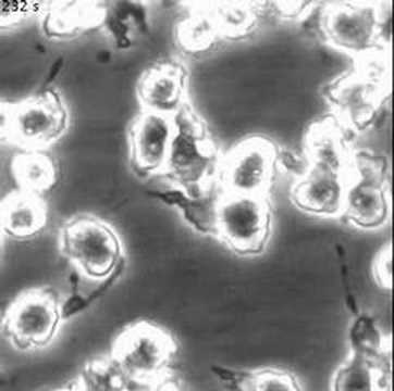 Trypsinisation of 3t3 cells, timelapse