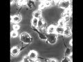 Trypsinisation of 3t3 cells, timelapse Trypsin
