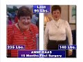 Mehta Bariatric Center infomercial Part 3