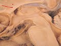 Neuroanatomy: Gross View @ Diencephalon