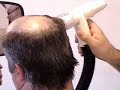 Cutting Your Hair with a Vacuum Cutter by Michigan Baldy Cutting Your Hair with a Vacuum Cutter by Michigan Baldy