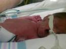 Baby Emma