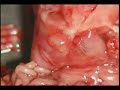 Ov�rios- avagabunda q colocou o feto no liquidificador...