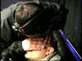 Forehead Hickey