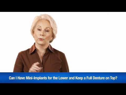Mini-Dental Implants Spokesmodel Video Demo Reel