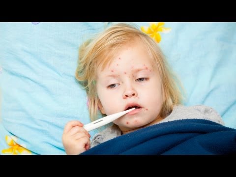 how to id a skin rash