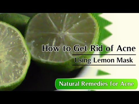 how to get rid of acne with lemon