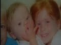 a mother does the impossible -- finds treatment for down syndrome, reversing the damage and substantially improves iq and quality of life.