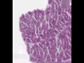 Shotgun Histology Three Muscle Types