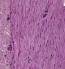 Shotgun Histology Three Muscle Types