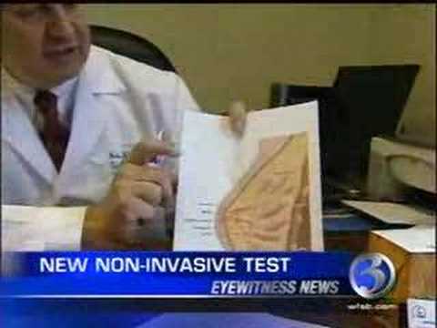 Breast Cancer Symptoms - NeoMatrix