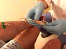 Hospital routine checkups -3, Blood extraction Hospital routine checkups -3, Blood extraction