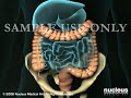 3D Medical Animation: Lower GI Colonoscopy (Sigmoidoscopy)