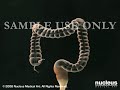 3D Medical Animation: Lower GI Colonoscopy (Sigmoidoscopy)