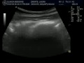 Ecograf�a de mi proxim@ sobrin@! - 9 semanas y 1/2!!