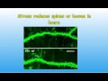 Dr Michael Vincent`s tree model of brain disease