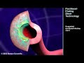 DHLI_PACLITAXEL EFFECTS Paclitaxel
