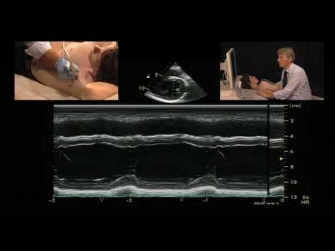 how to measure ejection fraction ultrasound