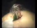 laparoscopic ovariectomy on dermoide ovarian cyst