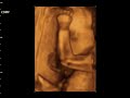 Dzaky Mom 6 Month Pregnant   4 Dimension UltraSonoGraphy 6 Ultrasonography