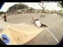 Skateboarding Accidents