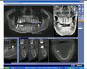 Diagnostik Implantologie Diagnostik Implantologie