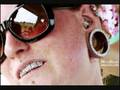 Aretes