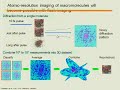 Cardiovascular Innovations Dennis Matthews