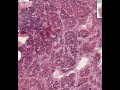 Shotgun Histology Pituitary