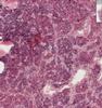 Shotgun Histology Pituitary