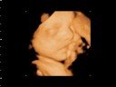 Angel Prints Ultrasound 3D 4D Ultrasound Lafayette