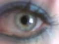 My Eye
