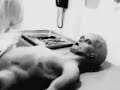 Santilli Roswell footage part 1 Santilli Roswell footage part 1