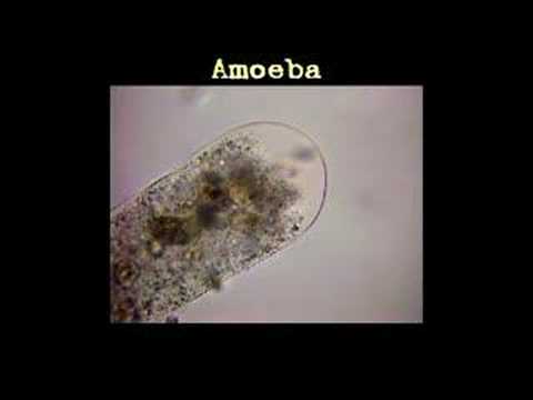 MicroSafari - Amoeba