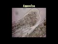 MicroSafari - Amoeba