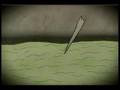 The Narwhal