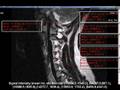 2008 Cervical Spine Signal Intensity Minimum Range: 5014.6 Hz - 17922.4 Hz