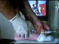 pedal venipuncture, if all else fails.infantsadults only with physician permission