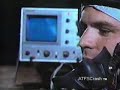 GLOC Gravity induced Loss Of Consciousness Part 2 of 2 GLOC Gravity induced Loss Of Consciousness Part 2 of 2