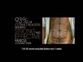 Slendertone-System-b