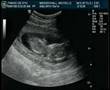 Elle's Ultrasound 12w1d